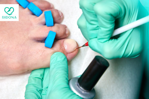 Pedicure Napoli